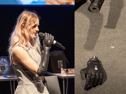 Teen Influencer Watches Her Bionic Hand Crawl Across a Table on Its Own