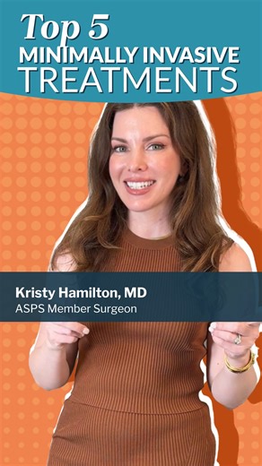 20 reactions | You're going to want to stop scrolling for this!  These were the top five minimally invasive procedures of 2024. Keep watching to see what aesthetic treatments made the list! ✨ #PlasticSurgeryStats #PlasticSurgeryTrends #BeautyTrends #MinimallyInvasiveProcedures #MinimallyInvasiveTreatments #Noninvasive #NonsurgicalProcedures #Aesthetics #AestheticGoals #AestheticHealth #Health #Beauty #ASPS #PlasticSurgery | American Society of Plastic Surgeons (ASPS) | Facebook