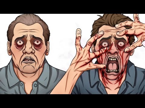 All Level of Pain Explained in 8 Minutes