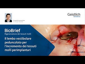 Il lembo vestibolare peduncolato per l’incremento dei tessuti molli perimplantari