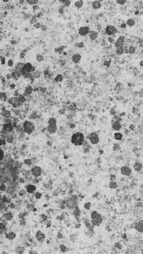 Most people think mold is only a problem when it’s visible, but the real danger lies in the mycotoxins it releases. These microscopic toxins circulate through the air, settle on surfaces, and enter the body, where they can quietly disrupt how the body feels and functions. Common signs of mold toxicity often go unnoticed: - Persistent fatigue or brain fog - Sinus congestion or headaches - Skin issues or flare-ups - Digestive problems or bloating - Increased sensitivity to smells or chemicals - Un