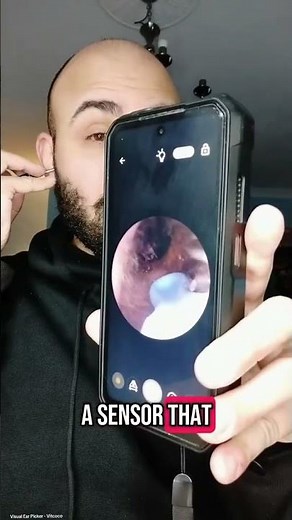 VITCOCO Ear Cleaner Otoscope 3.5mm WiFi – 5MP HD, Waterproof IP67, 6 LED Lights