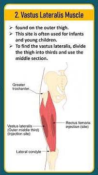 Sites of intramuscular injection l sites of injection