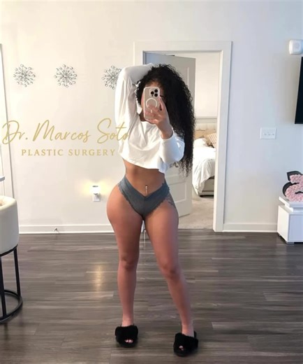 Transform Your Body with Lipo 360 and BBL