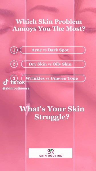 Which skin problem frustrates you the most? 🤔👇 💦 Dry Skin 🌑 Dark Spots 🛑 Acne 😣 Oily Skin ⚡ Wrinkles Drop your emoji in the comments & tell us why! Let’s see which one is the most common! 👇✨ #SkinRoutineTalks Sound credit: Quirky Eats By AlexGuz