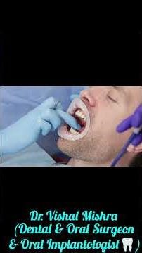 Dental Fillings