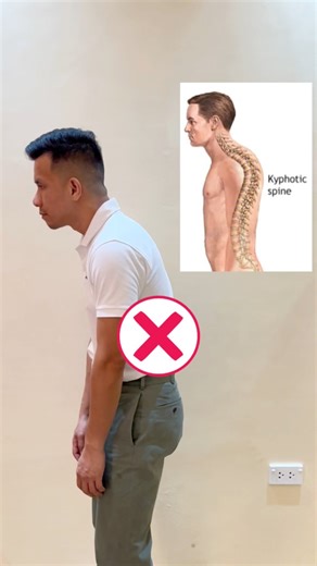 804K views · 9.7K reactions | POSTURE CORRECTION EXERCISE 朗朗朗 #posturecorrection #posture #exercise #physicaltherapy | Physical Therapy Session | Facebook