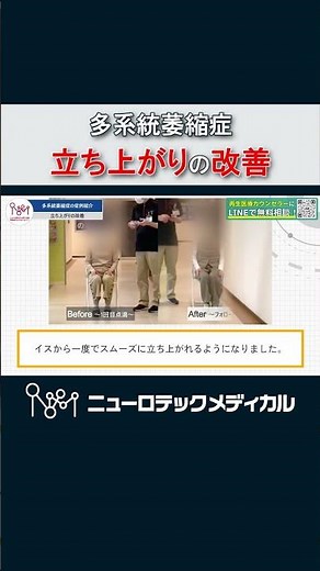 多系統萎縮症の患者様の体の立ち上がり動作の治療前後比較 【再生医療×同時刺激】