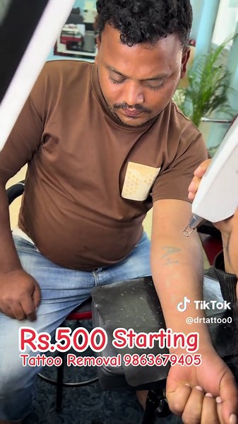 Tattoo Removal Services Starting at Rs.500