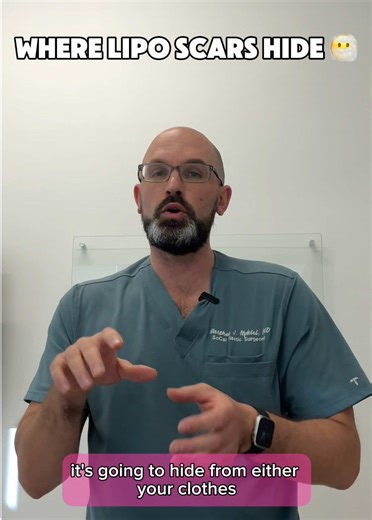 Here's the truth: liposuction scars can be some of the ugliest scars plastic surgery makes. The constant friction and rubbing from the cannula creates less-than-ideal scarring. So how do we fix this? We HIDE them strategically! Where We Place Liposuction Scars: ✨ In armpits ✨ Around breast folds ✨ Inside belly buttons ✨ In hairlines ✨ Under shadow lines from underwear The Goal? Hide scars from sight, even if they're not perfect! We place them where clothes or natural body contours will conceal t
