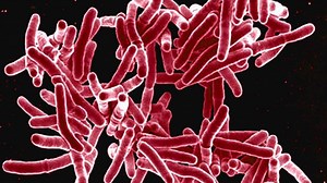 Tuberculosis: What You Need to Know - Mayo Clinic News Network