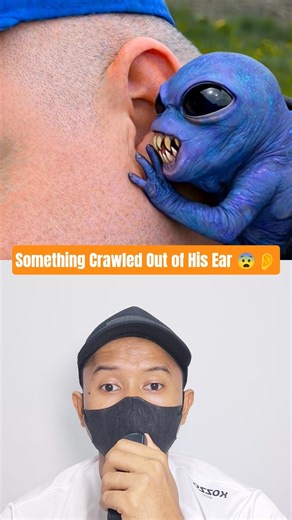Alien Baby Inside His Ear⁉️ FunnyClubTV