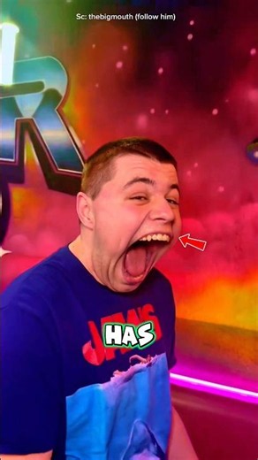 The Owner of the World's Biggest Mouth Shocks Everyone!