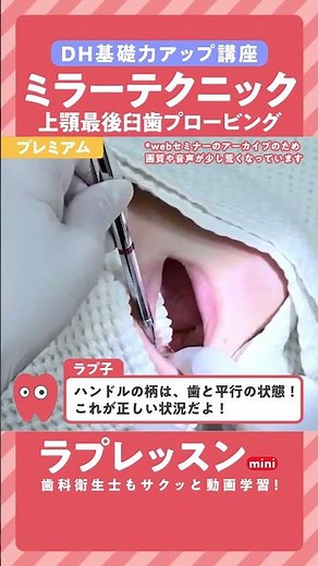 【ラプレッスンmini】サクッと学ぶDH基礎力アップ講座 ミラーテクニック③ 〜上顎最後臼歯プロービング時のミラーテクニック〜