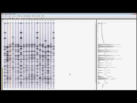 Import and analyze your first gel (BioNumerics 7)