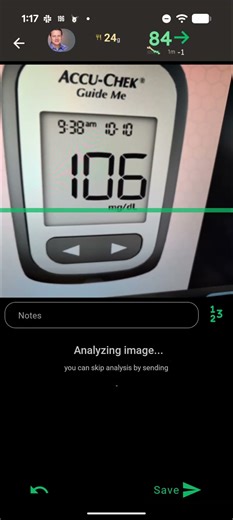 Gluroo logs blood sugar just from a photo (of the reading on your meter)