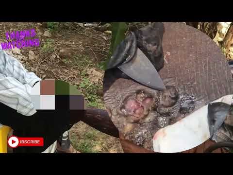 🤯 Extreme Jigger Removal – Hidden Parasites Under Rotting Skin! #YW01640