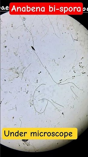 Anabaena bispora Explained | Structure, Heterocysts & Importance #algae #biology #science #shorts