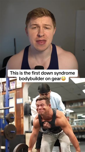 First Down Syndrome Bodybuilder on Gear