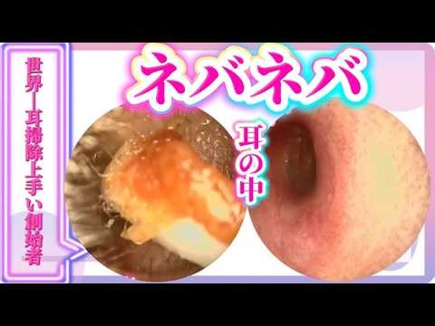 【プロの耳掃除「ネバネバ耳の中・・」】イヤーエステの創始者-パイオニア-「KYO」による歴23年のプロの技術を公開!!