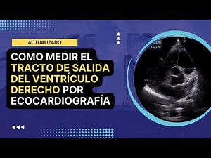 🏅[Cómo medir] el TRACTO DE SALIDA DEL VENTRÍCULO DERECHO (TSVD) por ecocardiografía: Actualizado
