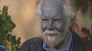 Paul Karason shocked the world when he went on national television showing his blue skin. | Inside Edition: Flashback