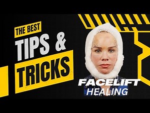 The 7 Day Facelift Recovery Blueprint: Avoid Mistakes and Heal Faster