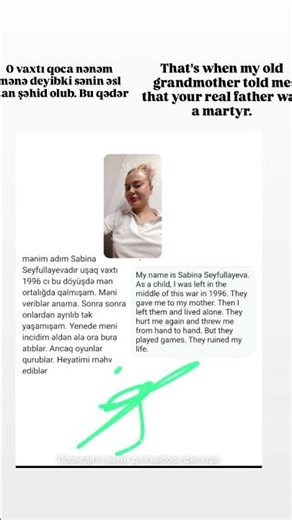 Salam üzündə çapiq olan Sabina Seyfullayevanın qısa həyat hekayəsi. Thank you.