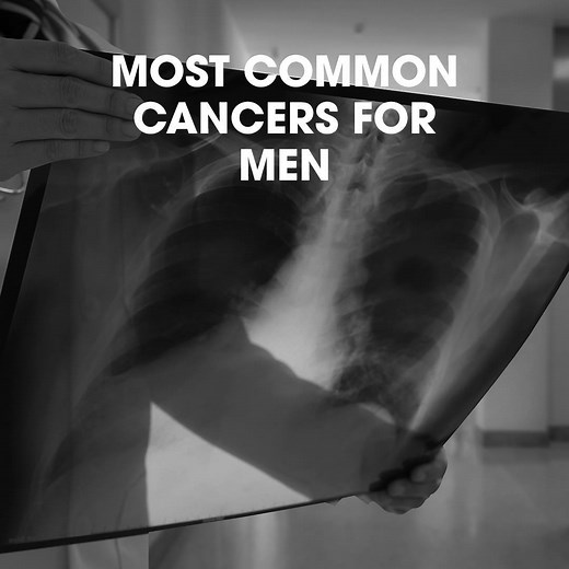 This Men’s Health Week, take a closer look at the 4 most common cancers in men, and learn why recommended screenings can help save your life. | Stand Up To Cancer