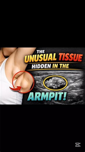The unusual tissue hidden in the armpit.