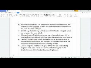 IP DRG CODING | Myocardial infarction | Clinical indicators| tamil explanation
