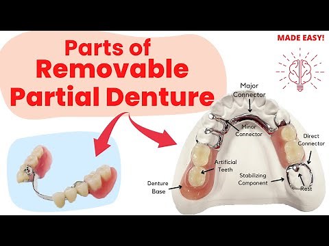 Parts of Removable Partial Denture - Short & Complete