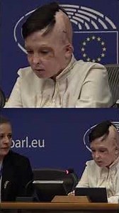 Translator SOBS While Speaking for Injured Ukrainian Boy Who Lost Mom in Russian Attack #shorts