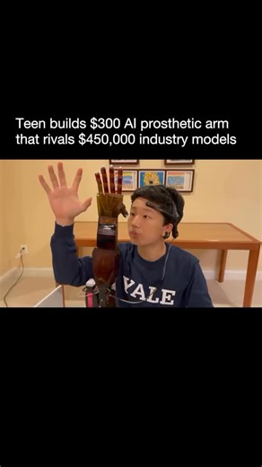 Meet Benjamin Choi, a high school senior who just redefined prosthetics. He developed an AI-powered, mind-controlled arm that costs $300 instead of $450,000. No risky brain surgery. No implants. Just non-invasive skin electrodes and artificial intelligence. Here’s how powerful it is: → 95% accuracy vs the industry’s 74% → 23,000 lines of handwritten code → 978 pages of advanced math → Runs on a $30 chip with no WiFi or cloud required → Can be controlled by thought, blink, or nod The result? A li