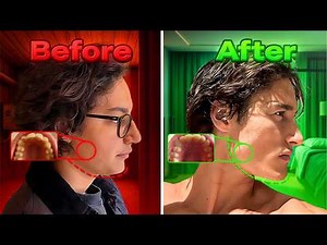 How To Do Thumbpulling 2.0 | 5 Minutes Every Day