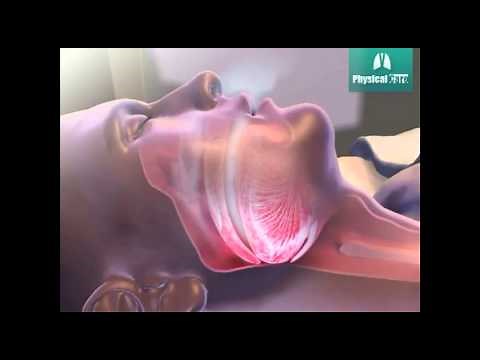 Como funciona o CPAP ou BIPAP?