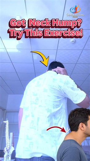 Fix neck hump with this simple exercise!