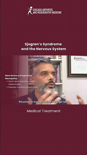 Medical treatment | Sjogren’s Syndrome and the Nervous System