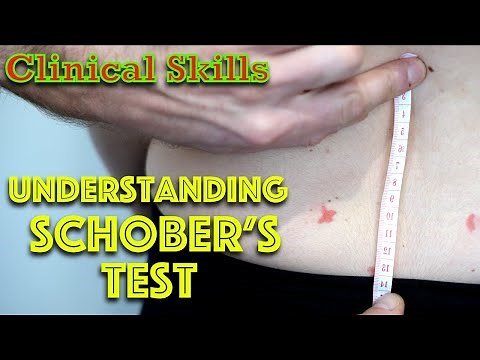 Low Back Pain - Schober's Test - Clinical Skills - Dr Gill