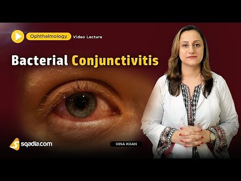 Bacterial Conjunctivitis | Ophthalmology Video Lecture