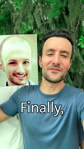 Locklab is a once-daily pill that's 97% effective at stopping hair loss in men.