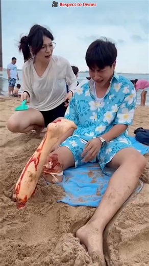 Unbelievable Beach Prank Gone Wrong: Leg Cut Panic! #short #prankvideo