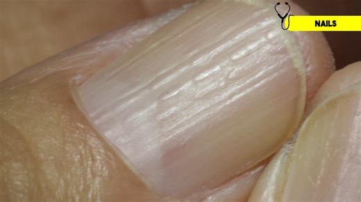 15 signs your thyroid is slowing everything down