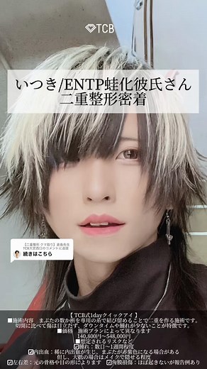 二重整形の最新技術と効果