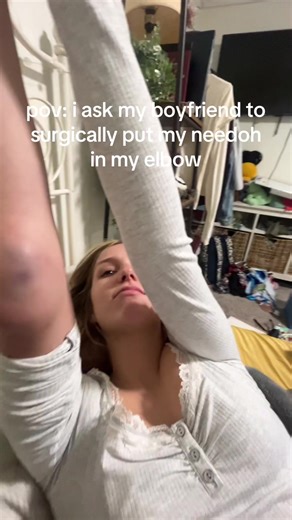 Managing a Bursa Sac Injury: Tips and Advice