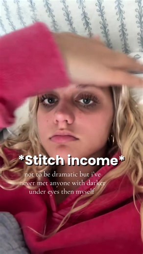 Understanding and Treating Dark Circles Under Eyes