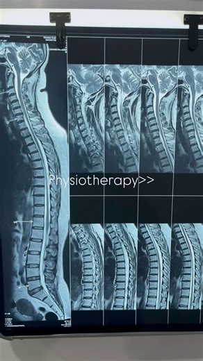 Dr.Mohammed Shakkir PT on Instagram: "Physiotherapy: Healing beyond pain, restoring the life you deserve♥️ #physiotherapy #physiotherapist #physios #treatment #patientscare #recovering #rehabilitation #sports #physiotherapy_world#physiostudents"