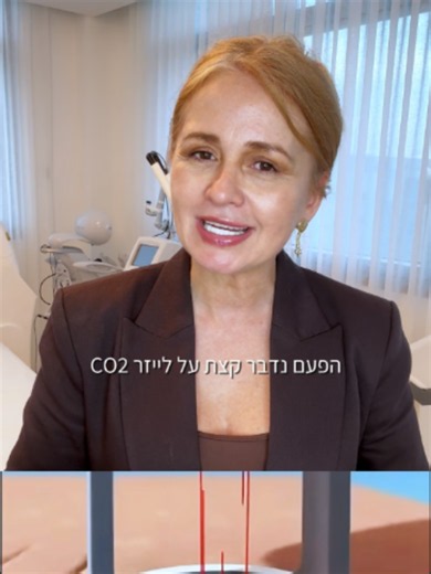 לייזר CO2 הוא אחת הטכנולוגיות המתקדמות והיעילות ביותר לטיפול בצלקות אקנה, משום שהוא מעודד ייצור קולגן חדש ומשקם את מרקם העור מבפנים. זהו טיפול עוצמתי שמאפשר לראות שינוי אמיתי באיכות העור, כשהוא מבוצע בצורה נכונה ומדויקת. כי בסופו של דבר, המטרה היא לא רק לטשטש את הצלקת – אלא לבנות מחדש עור בריא, אחיד וחזק יותר. ✨ 📩 רוצה לבדוק אם לייזר CO2 מתאים גם לך? שלחי לי הודעה ונבנה יחד את התכנית הנכונה לעור שלך.
