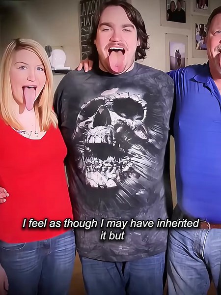 Cyst Removal with Dr. Pimple Popper: Satisfying Skin Care