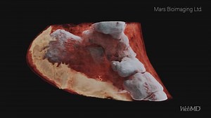 18K views · 129 reactions | Absolutely incredible -- take a look at these futuristic color X-rays. | WebMD | Facebook